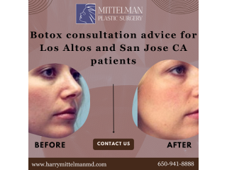Botox consultation tips for first-timers in Los Altos and San Jose CA